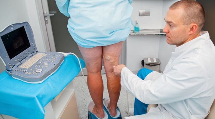 Diagnosi di vene varicose
