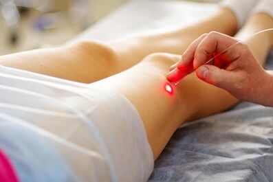 Terapia laser